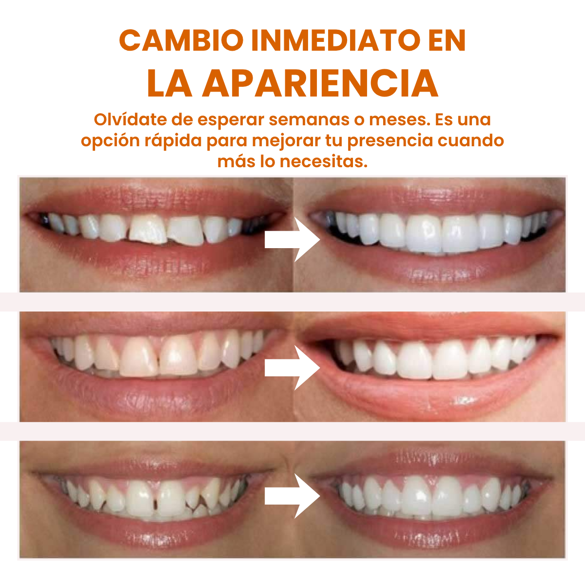 (COMPRA 1 LLEVA 2) Carillas Dentales Snap-On Smile: Tu Sonrisa Perfecta en Segundos, Sin Dentista